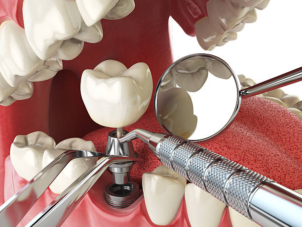 Best Broken or Cracked Tooth Emergency Dentist in Sheboygan Falls, WI